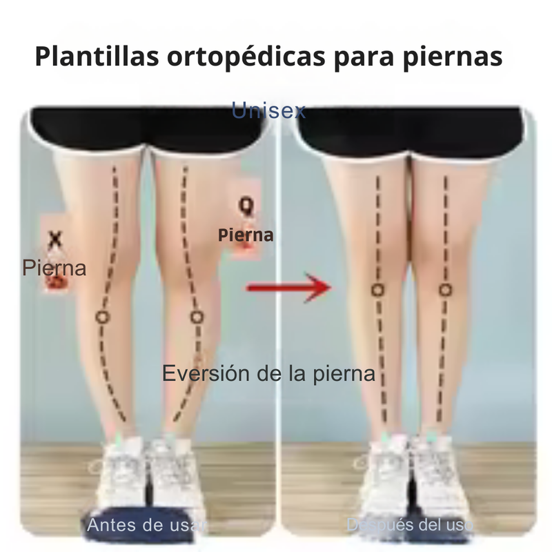 👣 OrthoStep Pro™ – Plantillas Ortopédicas de Gel Magnético
